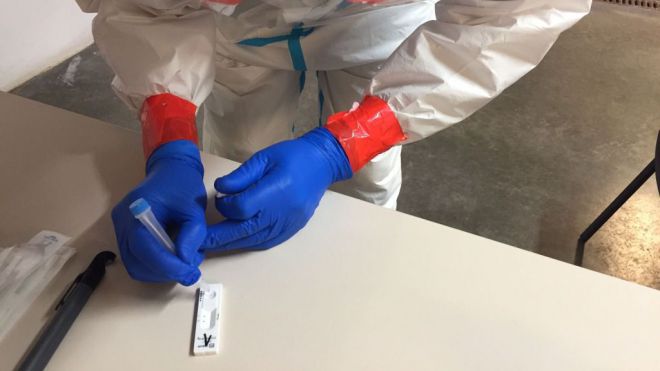 Sanidad registra 104 casos de COVID-19 en las últimas 24 horas