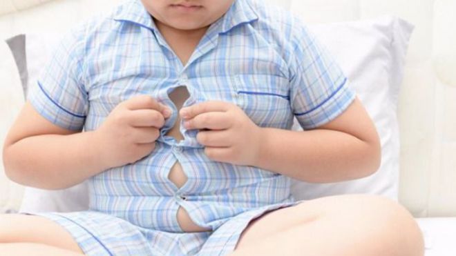 La obesidad infantil en Canarias supera la media nacional al alcanzar el 43,31%