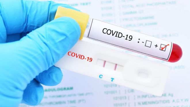Sanidad comunica 376 casos de COVID-19 en las últimas 24 horas