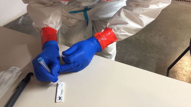 Sanidad registra 1.545 casos de COVID-19 y el fallecimiento de nueve personas