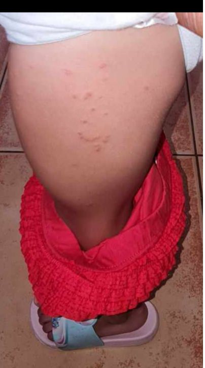 Denuncian existencia de una plaga de pulgas en el centro cívico de Charco del Pino