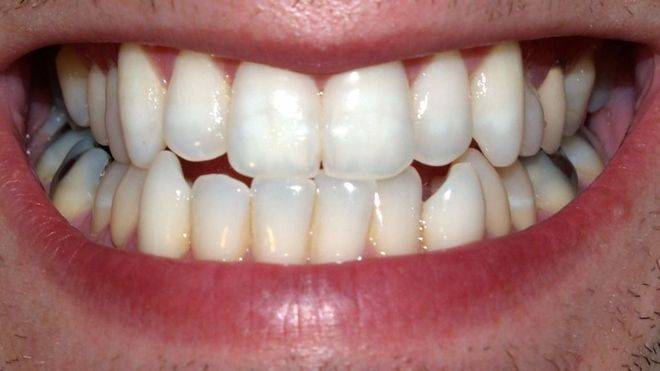 Imagen de los dientes
