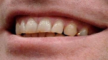 Dijo que su víctima se había reído de él