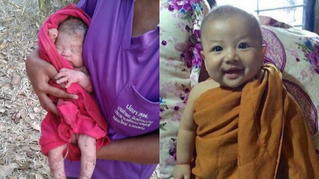 Dos imágenes del bebé 'milagro' cuando fue rescatado y en la actualidad