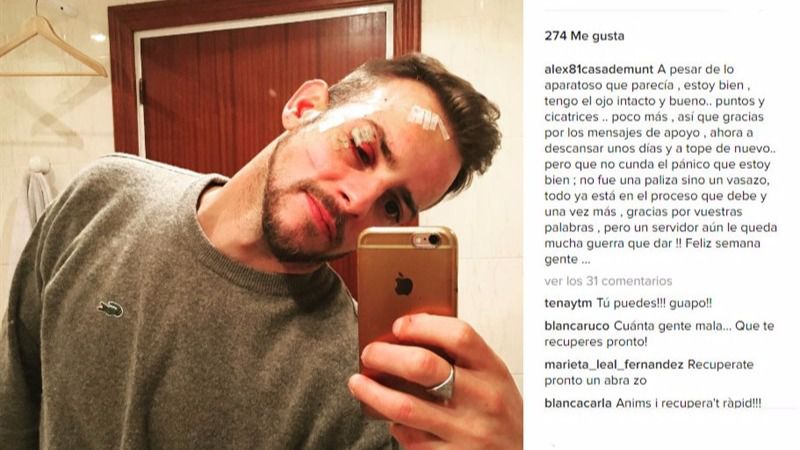 Le rompieron un vaso en la cara en una discoteca de Vigo