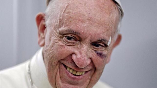 papa francisco golpe