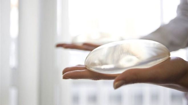 Una mujer condenada a devolver los 8.000 euros que cogió de su marido para un aumento de pecho