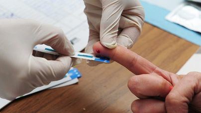 1 de cada 5 infectados de VIH en España no está diagnosticado