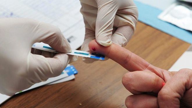 1 de cada 5 infectados de VIH en España no está diagnosticado