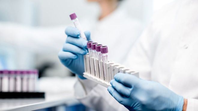 El brote de listeriosis en Andalucía se cobra su primera víctima mortal