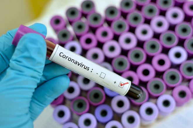 Sanidad sospecha de casos de coronavirus en España