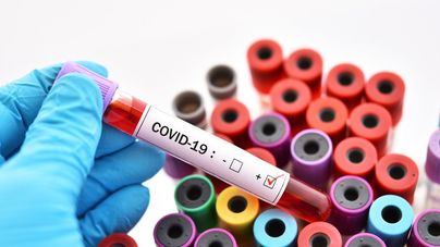 El número de positivos por coronavirus en España se eleva a 120