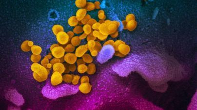 El coronavirus aguanta hasta tres días en algunas superficies y puede transmitirse por el aire