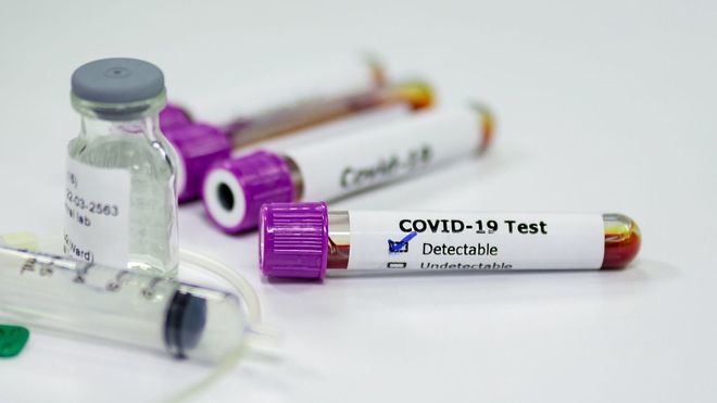 Turquía suma más de 3.000 contagios y 24 muertes de sanitarios por coronavirus