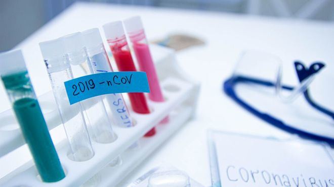 China rechaza la investigación sobre el origen del coronavirus y la tilda de 'politizada'