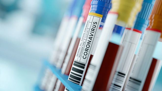 Rusia suma más de 10.000 casos de coronavirus en un día