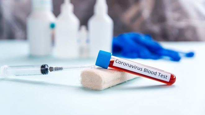 Cada día se detectan en España entre 10.000 y 12.000 casos sospechosos de coronavirus