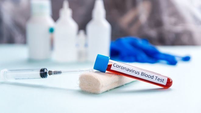 Estados Unidos supera los 2 millones de contagios de coronavirus