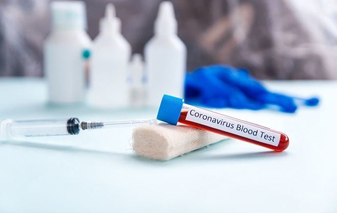 Sanidad notifica 1.895 nuevos casos de coronavirus, 200 más que el jueves