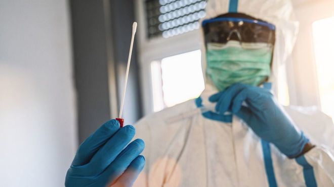 Mas de 20 millones de contagios de coronavirus en todo el mundo
