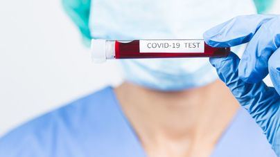 Enfermeras y médicos se posicionan en contra del test Covid en las farmacias