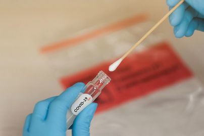 Los científicos advierten que los test rápidos de detección de anticuerpos Covid 19 son ineficaces