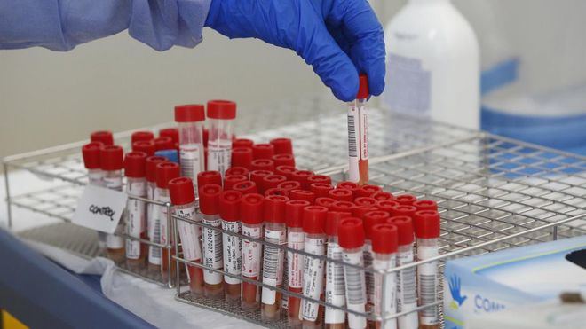 Repunte al alza de nuevos contagios en España, con 4.595 casos en el recuento diario