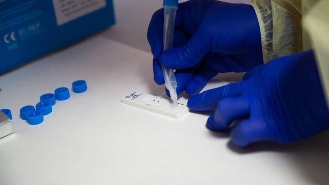 La tasa de incidencia en España ya supera los 230 casos, aunque descienden los diagnósticos