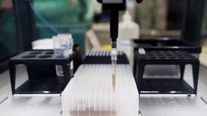 323 casos confirmados de viruela del mono en España