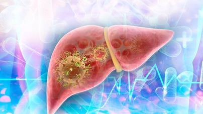 Sanidad confirma las dos primeras muertes en España por hepatitis de origen desconocido