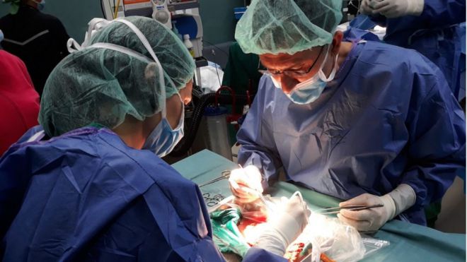 Los 36 donantes de órganos en Canarias han permitido realizar 62 trasplantes