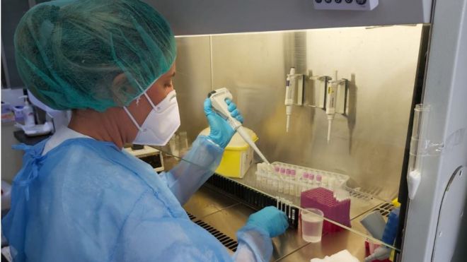 Sanidad notifica 152 casos de COVID-19 en las últimas 24 horas