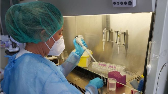 Sanidad notifica 202 casos de COVID-19 en las últimas 24 horas
