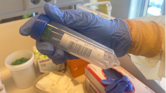 Sanidad notifica 175 casos de COVID-19 en las últimas 24 horas