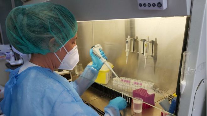 Sanidad notifica 151 casos de COVID-19 en las últimas 24 horas