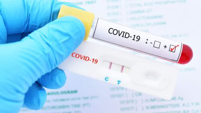 Sanidad constata 97 casos de COVID-19 en las últimas 24 horas