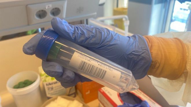 Sanidad constata 169 casos de COVID-19 en las últimas 24 horas
