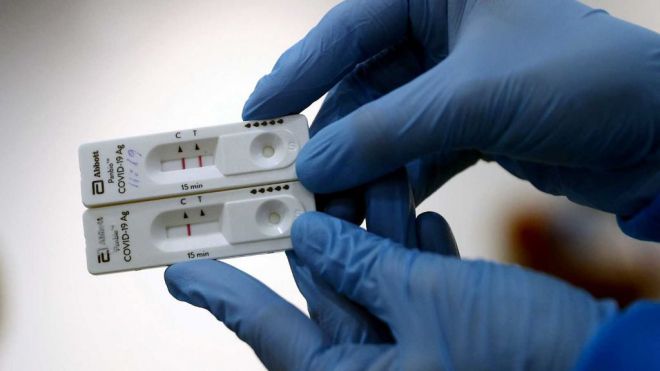 Sanidad notifica 195 casos de COVID-19 en las últimas 24 horas
