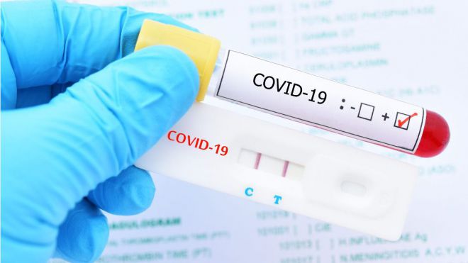 Sanidad registra 340 casos de COVID-19 en las últimas 24 horas