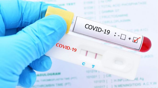 Sanidad comunica 105 casos de COVID-19 en las últimas 24 horas