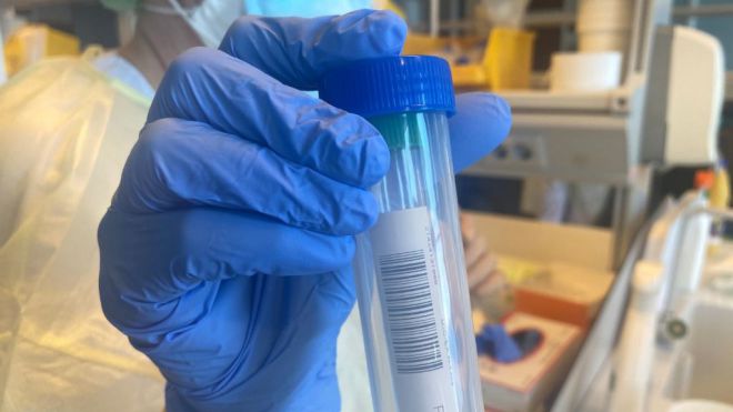 Sanidad comunica 78 casos de COVID-19 en las últimas 24 horas