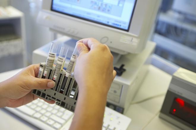 Sanidad descarta el caso bajo investigación por sospecha de hepatitis infantil aguda de origen desconocido