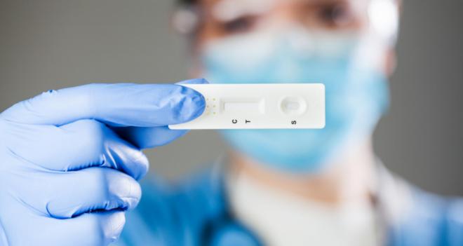 Sanidad registra 2.063 casos de COVID-19 y el fallecimiento de cinco personas