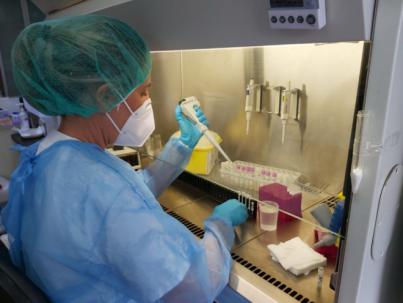 Sanidad notifica un caso confirmado de viruela del mono