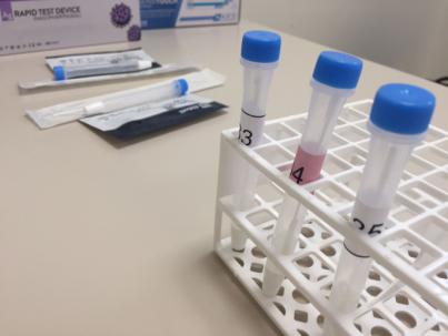 Sanidad contabiliza 6.327 casos de COVID-19 y el fallecimiento de 15 personas