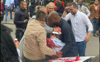 Disparan en la cabeza al precandidato presidencial colombiano Miguel Uribe