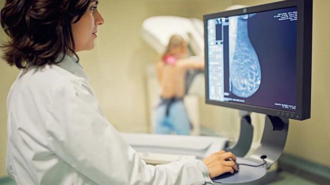 Un nuevo fármaco mejora la respuesta al cáncer de mama HER2+ precoz