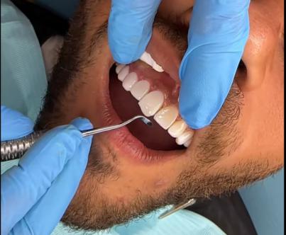 Los dentistas alertan sobre el turismo dental en Marruecos