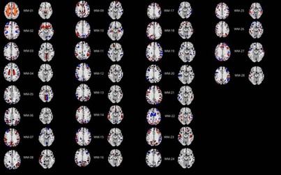 Estudio revela nuevas claves sobre el Trastorno de la Personalidad Obsesivo-Compulsiva