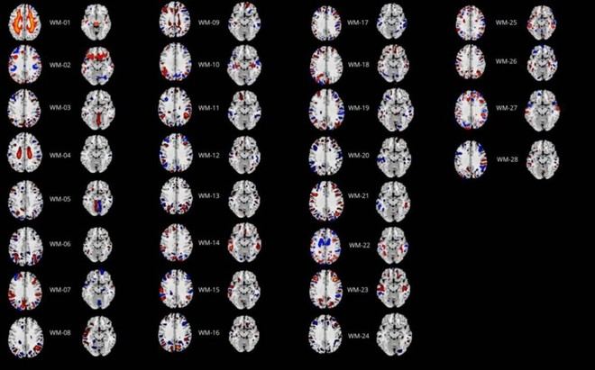 Estudio revela nuevas claves sobre el Trastorno de la Personalidad Obsesivo-Compulsiva